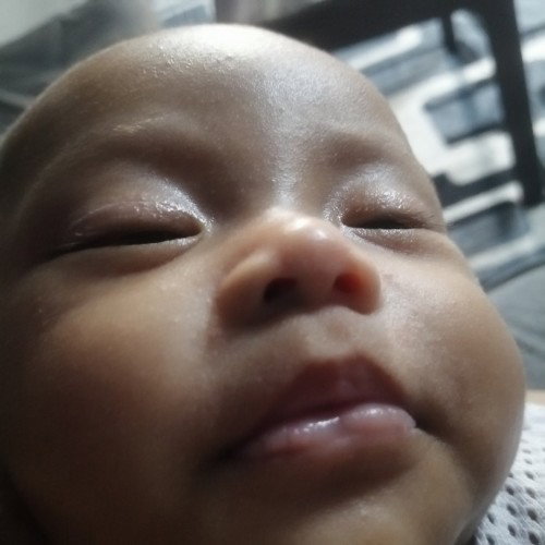 Tak pasti sbb alahan susu fm atau sbb cuaca atau persekitaran rumah