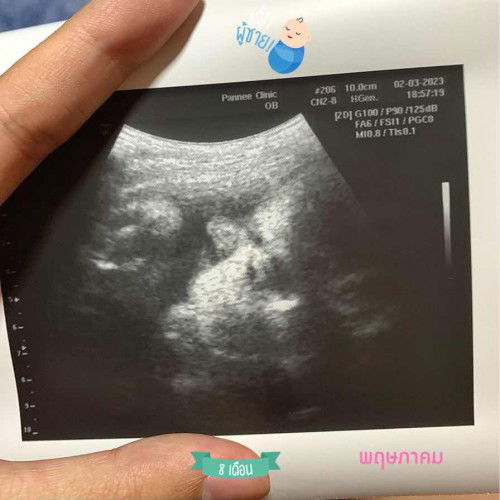 ใบอัลตร้าซาวด์คะ