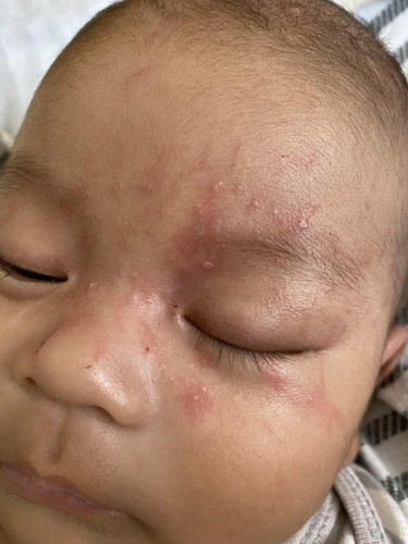 euam ruam di area mata