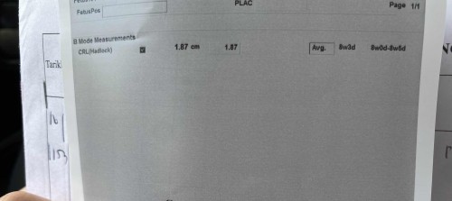 scan tak sama 😅