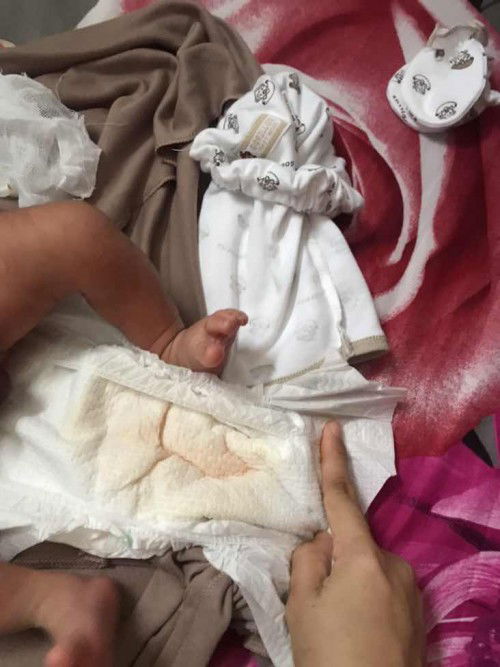 Warna pipis baby new born