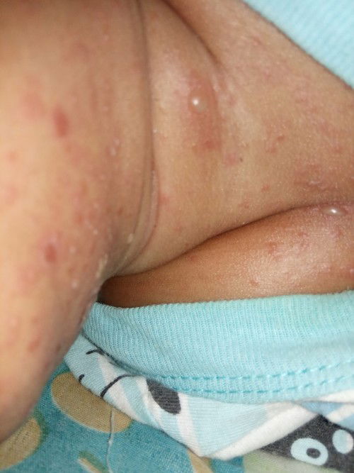 Share pengalamannya bundaa