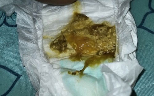 Normalke najis baby nak masuk 6bulan mcm ni? Pagi td najis dia cair yg ni ada lendir pulak
