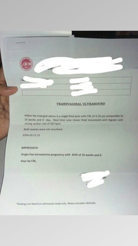 Transvaginal ulthra.