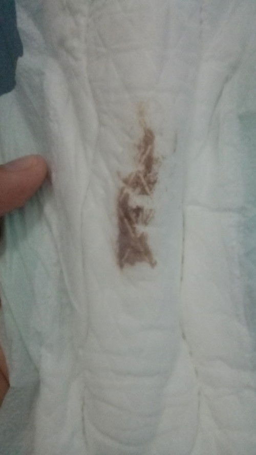 Bund mau tanya kehamilan saya 7 Minggu 2 hari tapi malah keluar flek warna kecoklatan itu bagaimana?