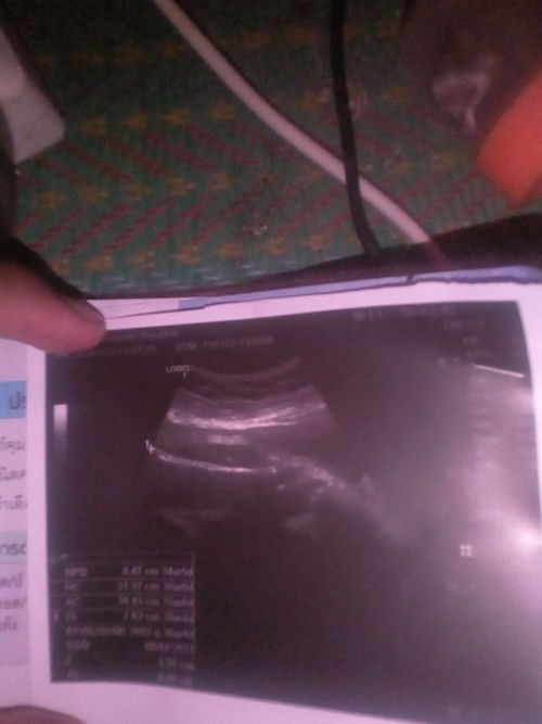 เเม่ๆว่าน้อง