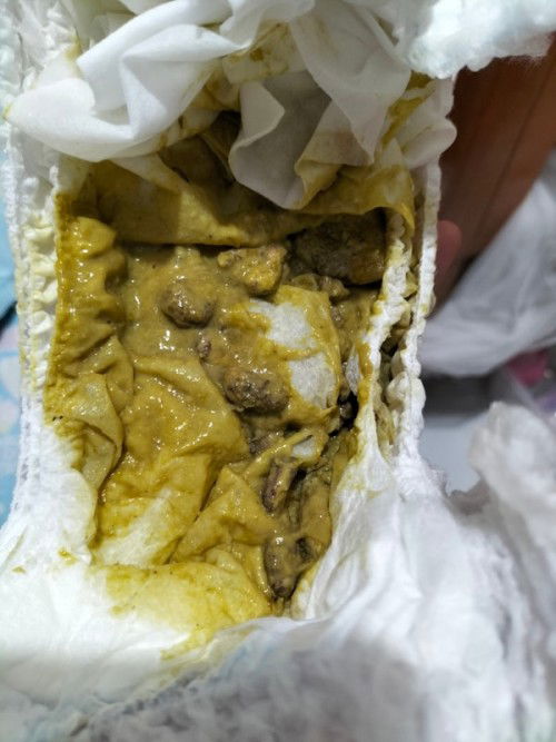 Poops 
Hi po cno n nk experince 1yo n c lo prang mhina panunaw nya saging po yang mdjo buo sa poops