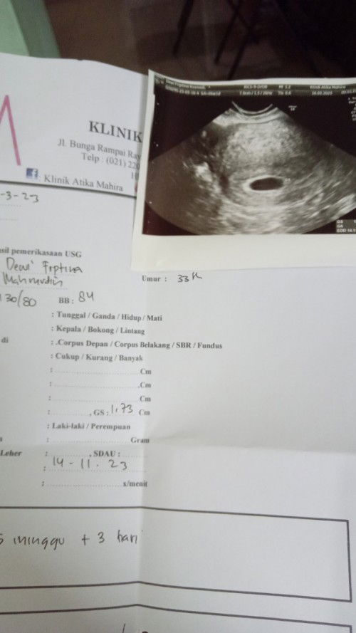 USG 5  minggu