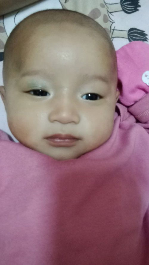 Kelopak mata bayi biru