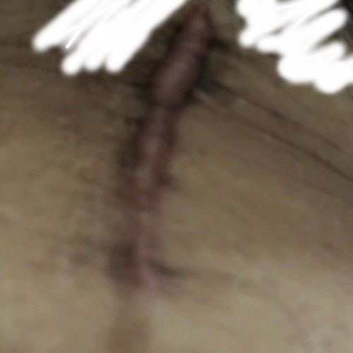 Killoid cs parang tumataba lower lart