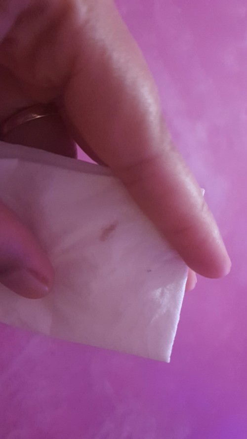 Ini termasuk flek atau tidak?