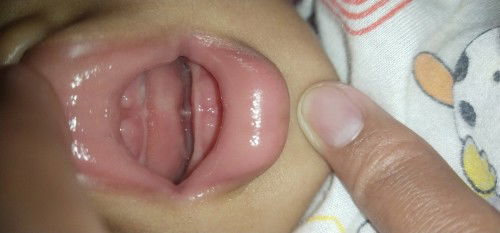 apakah ini akan tumbuh gigi