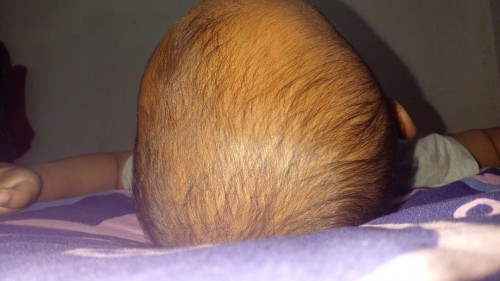 Bunda ada yg anak nya udah 3 tahun tapi masih botak gak?penumbuh rambut apa dong yg bagus