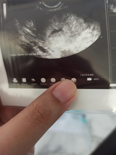kantung bentuk bulan sabit tak bulat