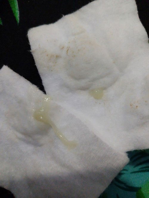 keputihan atau bukan