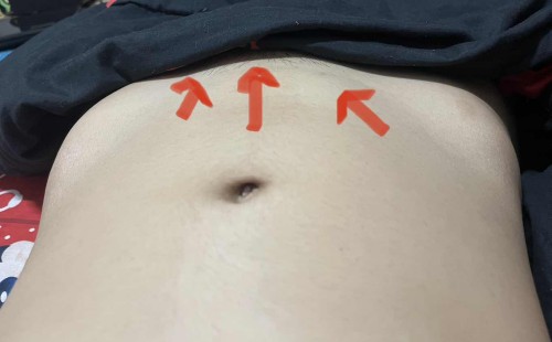 ท้องแบบนี้ปกติกไหมคะ ท้องแรก