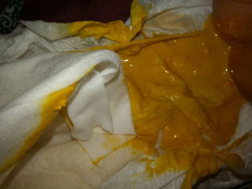 Bunda mau tanyaa, anak yang full asi fesesnya kayak gmna yaa. Yg anaku kyk gni