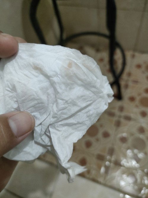 Flek pink usia kandungan 23w