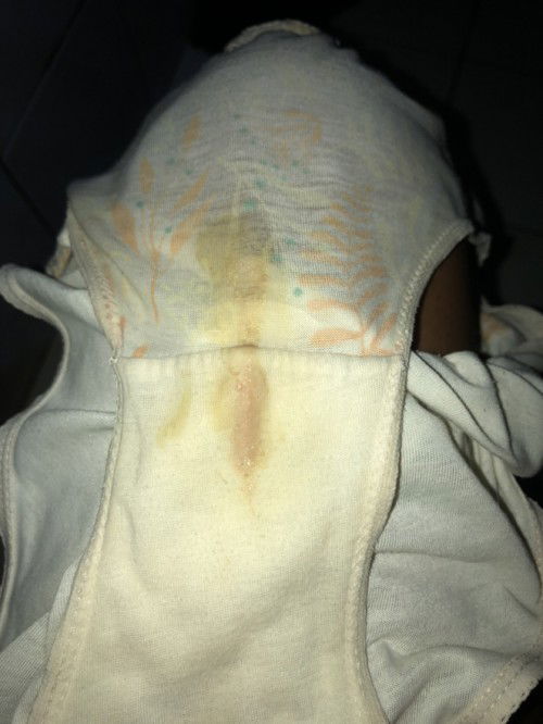 Discharge pag tapos ie