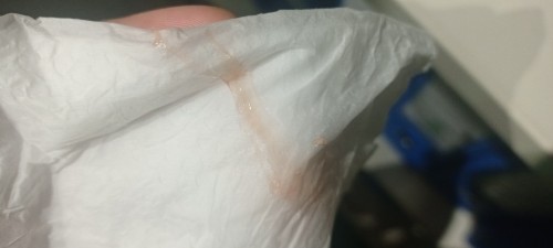 Brownish Discharge