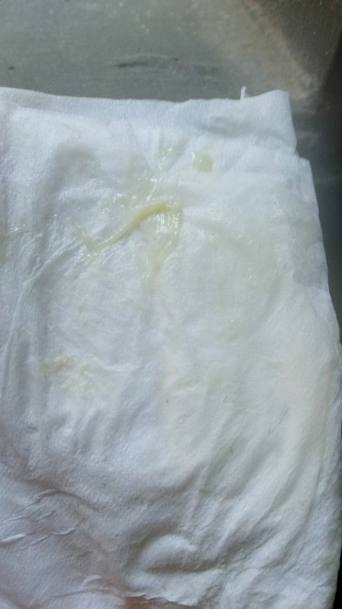Bun mw tanya hpl udah lewat 2hr...td pagi keluar seperti lendir wrna putih2 kuning kental itu apa