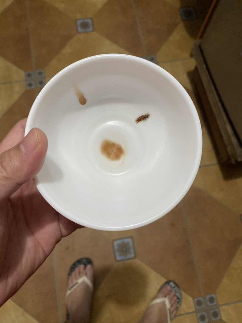 What is this weird thing that came out of my v