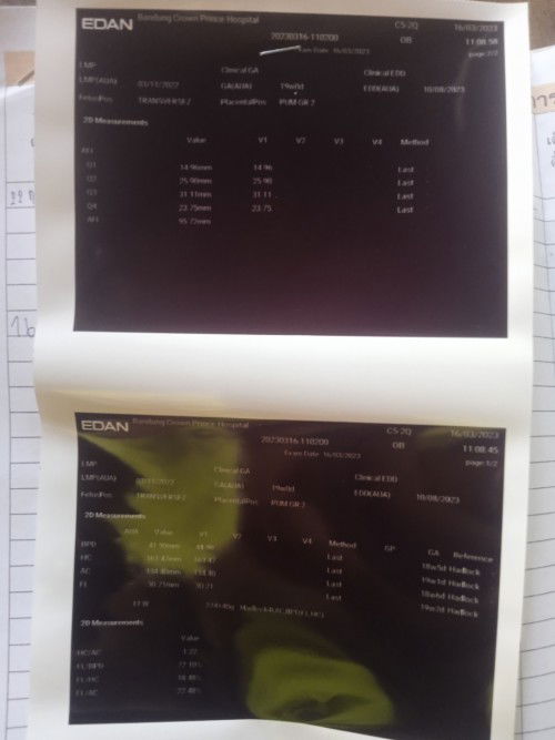 หลังจาก19w