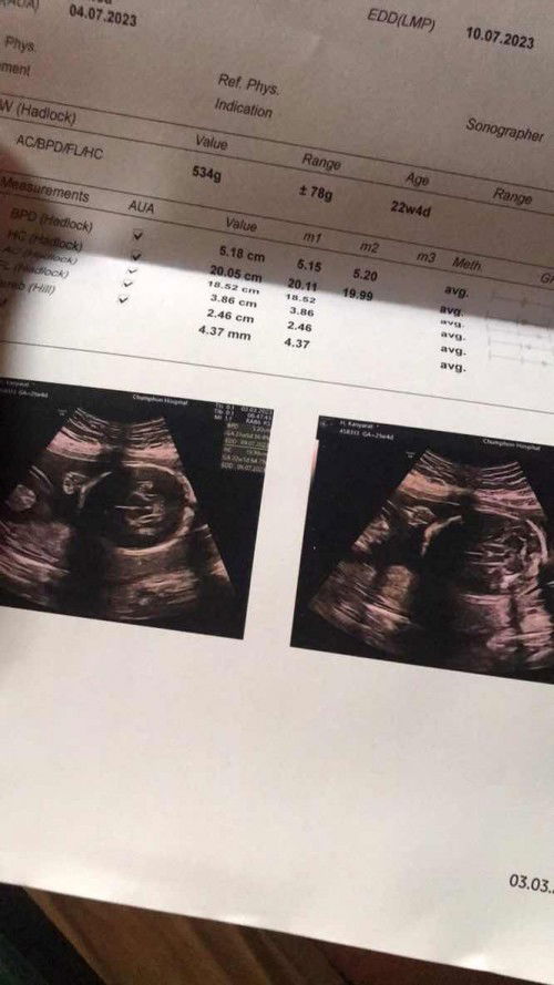 แม่ๆช่วยดูหน่อยค่ะ ว่าหญิงหรือชาย พอจะดูออกมั้ยคะ🙏🏻❤️