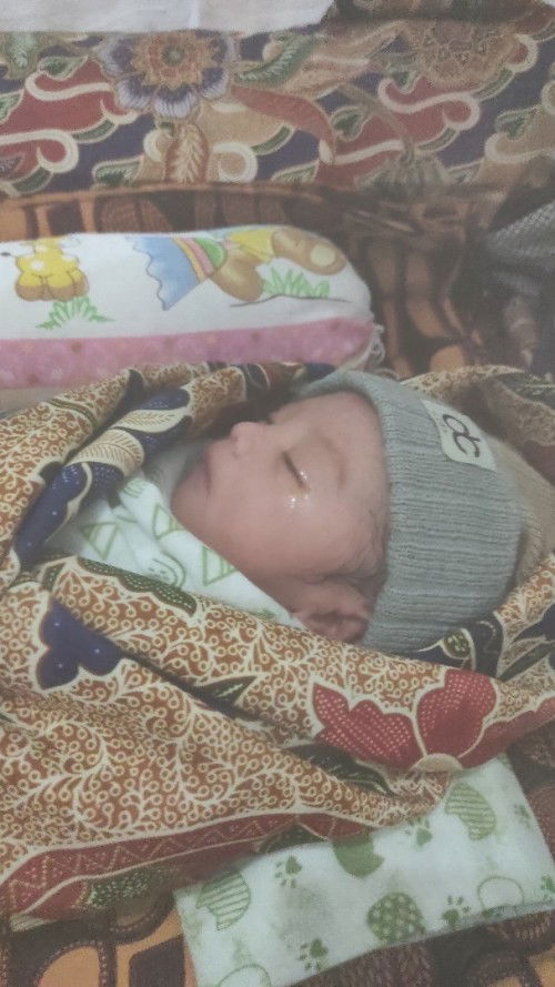 Alhamdulillah hpl 29 maret, udah lounching di tgl 17 maret baby boy BB 2,3kg bonus jahitan luar dlm