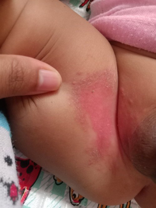 Selangkangan merah