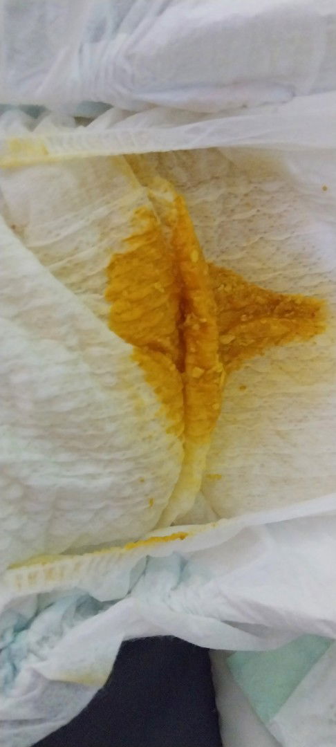 Bab normal bayi 1 bln