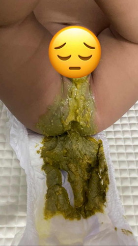 Najis bayi hijau dan cair