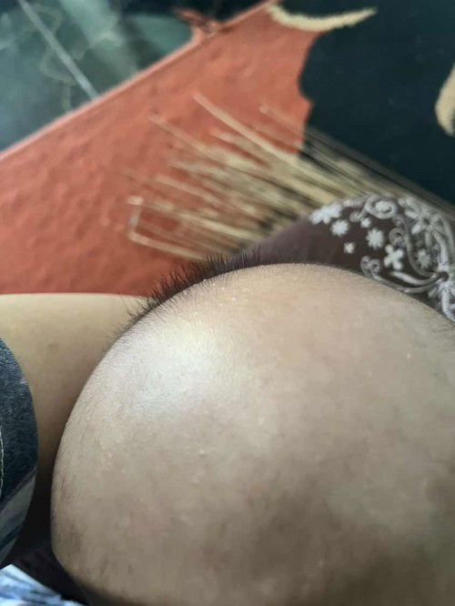 Bund, ada yang tau ini kenapa? Dan ada yg tau cara menghilangkannya pake apa?