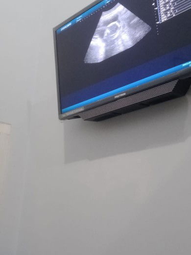 Usia kandungan 21minggu