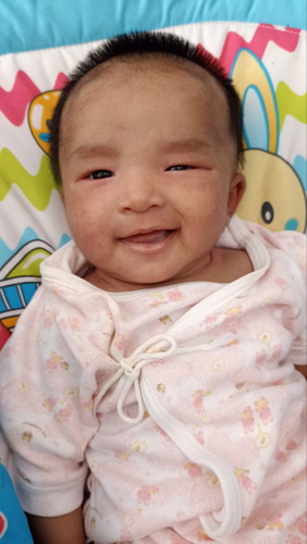 ลูกเป็นภูมิแพ้