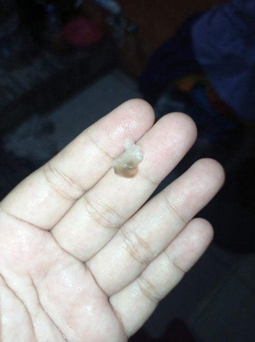 Tanda tanda kontraksi