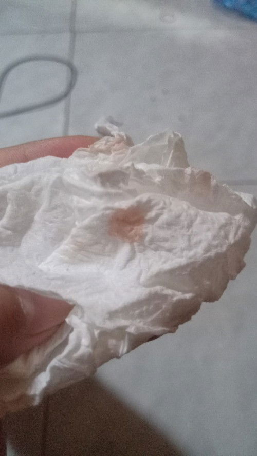 Mau bertanya keluar flek di usia 4w4d bahaya atau tidak