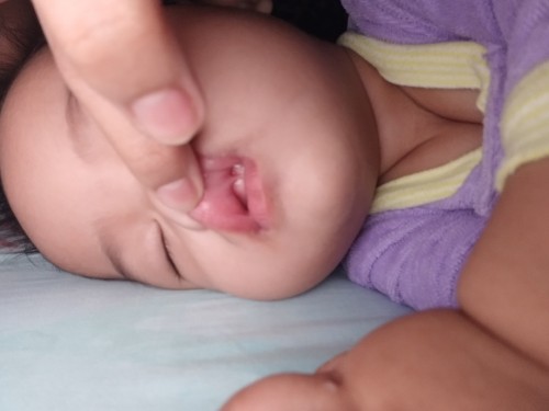 Hi po mommies. Tanong ko lang po kung mukhang teething na po ba to?