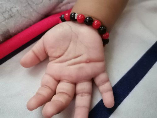 Hello po. Ano po kaya itong nasa palad ng baby ko? Anu po kayang gamot dito.?Salamat po ☺️