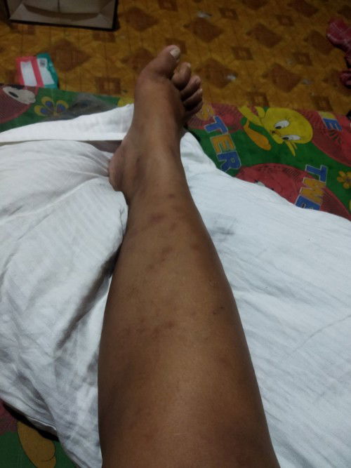 May same case BA sakin DITO na nagkaganito 9months