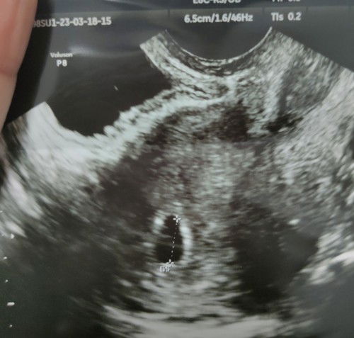 แม่ๆช่วยดูหน่อยค่ะ