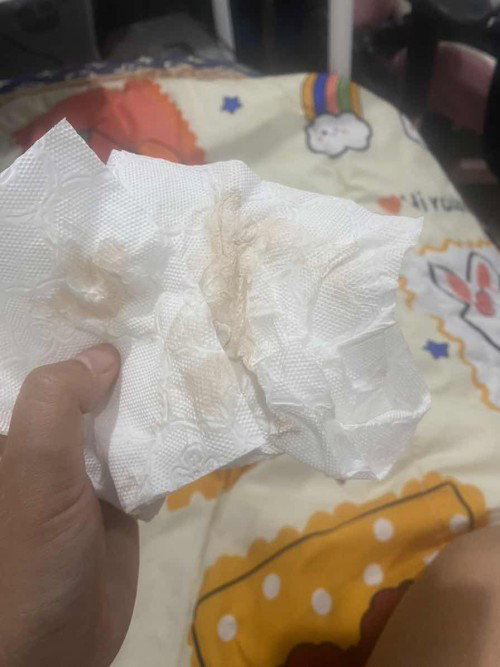ตกขาวเป็นสีนี้ใช่เลือดไหมคะ