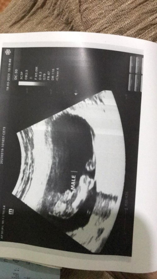 15W3d คุณแม่แต่ละบ้านหนักกันเท่าใหร่แล้ว