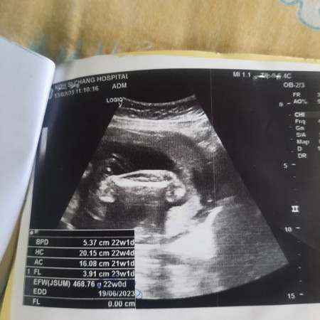 อยากรู้ว่านี่คือส่วนใหนของน้องหรอค่ะ