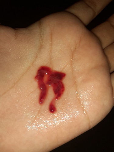 Miscarriage na po ba ang ganto? Huhu
