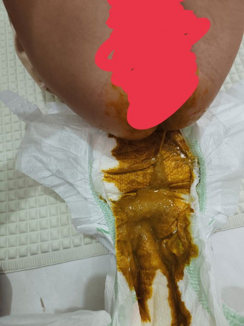 Baby's Poop