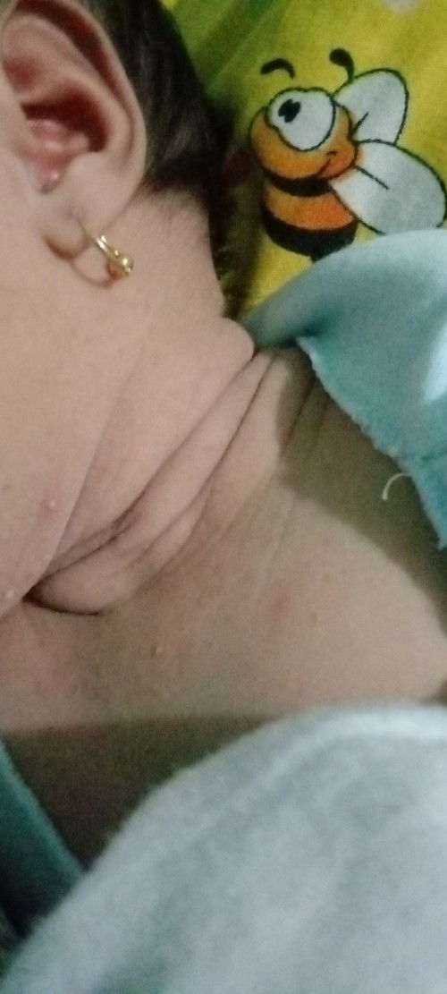 Kulit bayi bintik bintik