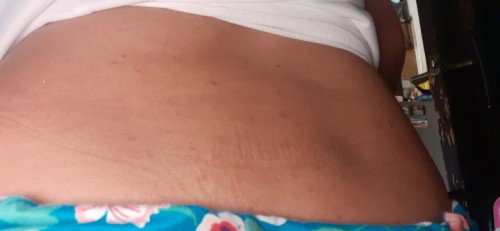 Lower back pain after manganak, normal po ba?