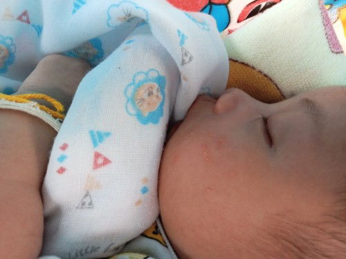 แม่ๆค่ะลูกน้อยเป็นผื่นที่หน้าแบบนี้ทำยังงัยดีค่ะ ทายาที่หมอให้มาแล้วก็ยังไม่หาย