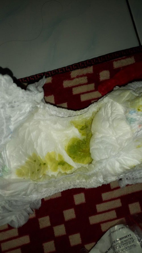 Feses bayi 5 bulan warna hijau
